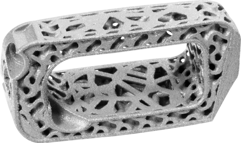 3d printed spine implant 